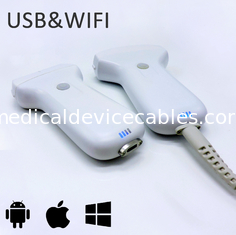 Van de de Weergave Lineaire Serie van USB WIFI Digitale Draadloze de Ultrasone klanksonde